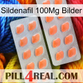 Sildenafil 100Mg Images 27